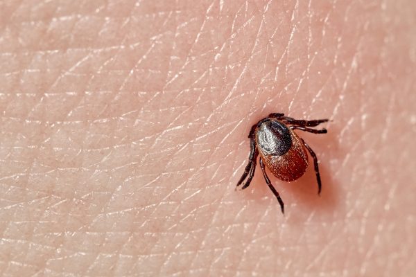 Close up of tick on skin